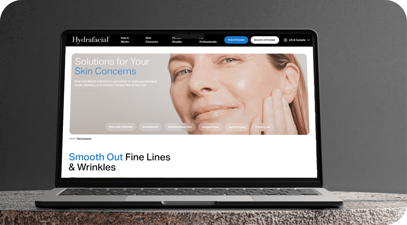Hydrafacial